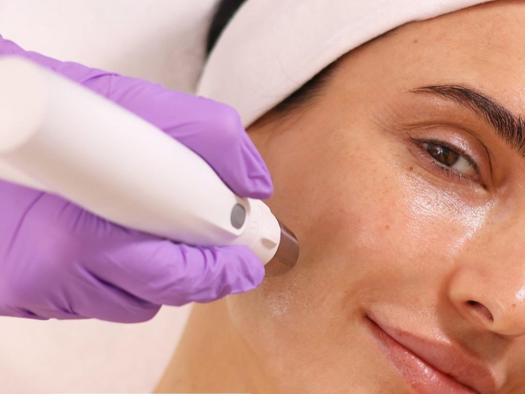 DERMADROP TDA Gesichtsbehandlung im SkinConcept in Wien Hietzing